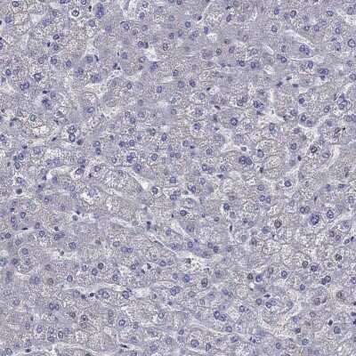 Immunohistochemistry-Paraffin: Filamin Antibody [NBP3-17124]