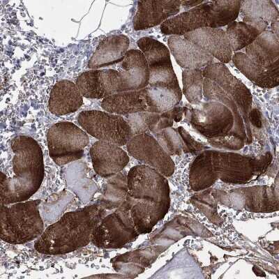 Immunohistochemistry-Paraffin: Filamin Antibody [NBP3-17124]
