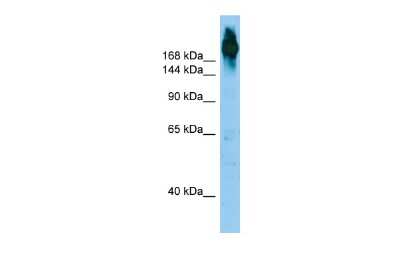 Western Blot: Filamin Antibody [NBP2-84023]