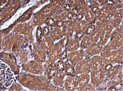 Immunohistochemistry-Paraffin: Filamin B Antibody (1372) [NBP2-43732]
