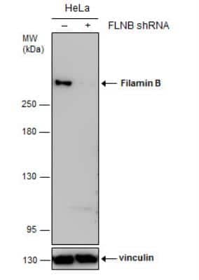 Western Blot: Filamin B Antibody (1372) [NBP2-43732]