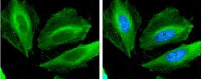 Immunocytochemistry/ Immunofluorescence: Filamin B Antibody (387) [NBP2-43740]
