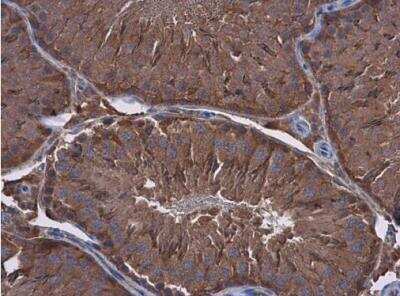 Immunohistochemistry-Paraffin: Filamin B Antibody (387) [NBP2-43740]