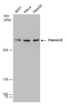 Western Blot: Filamin B Antibody (387) [NBP2-43740]