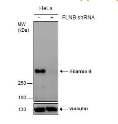 Western Blot: Filamin B Antibody (387) [NBP2-43740]