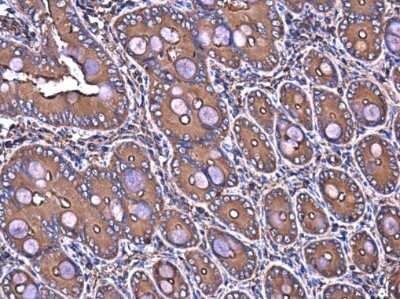 Immunohistochemistry-Paraffin: Filamin B Antibody (GT1282) [NBP3-13527]
