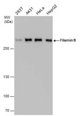 Western Blot: Filamin B Antibody (GT1282) [NBP3-13527]