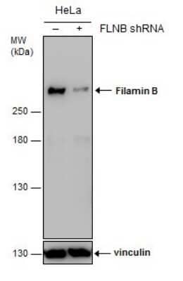 Western Blot: Filamin B Antibody (GT1282) [NBP3-13527]