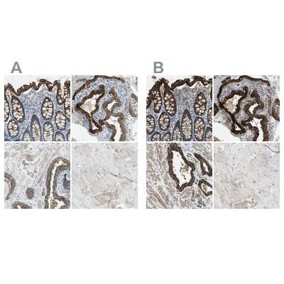 Immunohistochemistry-Paraffin: Filamin B Antibody [NBP1-90285]