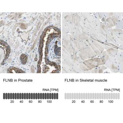 Immunohistochemistry-Paraffin: Filamin B Antibody [NBP1-90285]