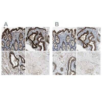 Immunohistochemistry-Paraffin: Filamin B Antibody [NBP1-90286]