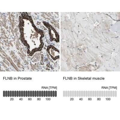 Immunohistochemistry-Paraffin: Filamin B Antibody [NBP1-90286]