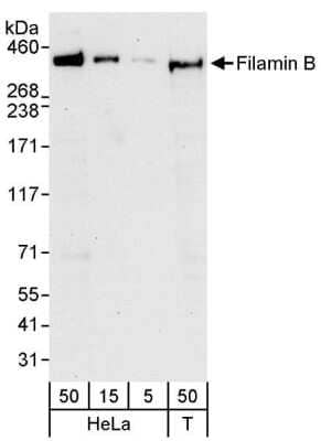 Western Blot: Filamin B Antibody [NB100-88143]