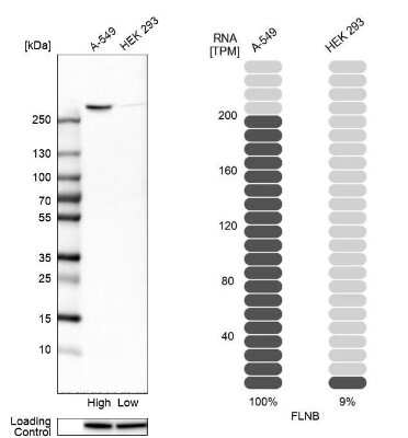 Western Blot: Filamin B Antibody [NBP1-90286]