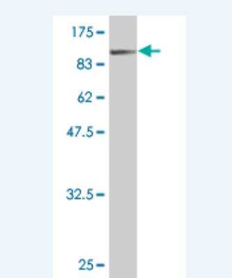 Western Blot: Filensin Antibody (1B11) [H00000631-M01]