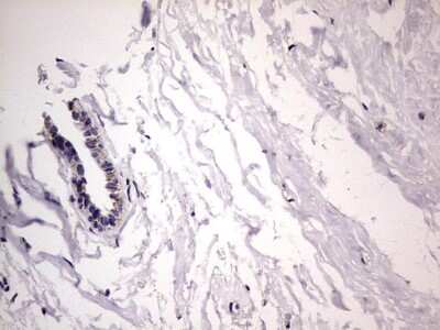 Immunohistochemistry: Filensin Antibody (OTI2B2) [NBP2-46572]
