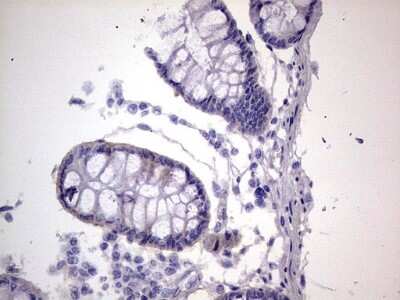 Immunohistochemistry: Filensin Antibody (OTI2B2) [NBP2-46572]