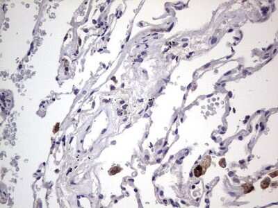 Immunohistochemistry: Filensin Antibody (OTI2B2) [NBP2-46572]
