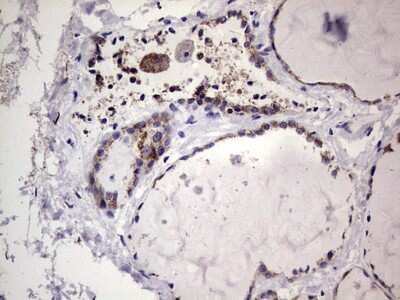Immunohistochemistry: Filensin Antibody (OTI2B2) [NBP2-46572]