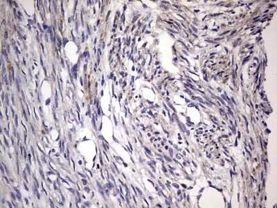 Immunohistochemistry: Filensin Antibody (OTI2B2) [NBP2-46572]