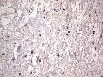 Immunohistochemistry: Filensin Antibody (OTI2B2) [NBP2-46572]