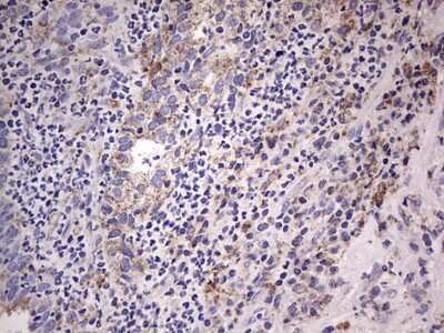 Immunohistochemistry: Filensin Antibody (OTI2B2) [NBP2-46572]