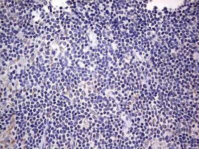 Immunohistochemistry: Filensin Antibody (OTI2B2) [NBP2-46572]