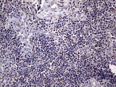 Immunohistochemistry: Filensin Antibody (OTI2B2) [NBP2-46572]