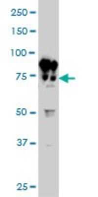 Western Blot: Filensin Antibody (6B4) [H00000631-M02]