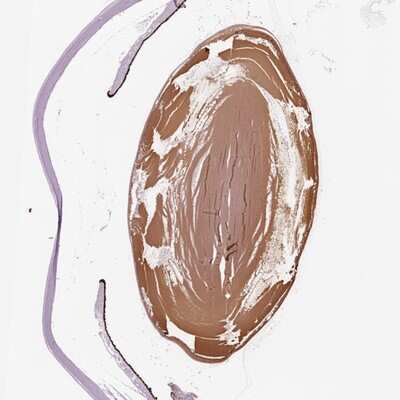 Immunohistochemistry-Paraffin: Filensin Antibody [NBP1-91903]
