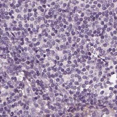 Immunohistochemistry-Paraffin: Filensin Antibody [NBP1-91903]