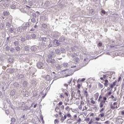 Immunohistochemistry-Paraffin: Filensin Antibody [NBP1-91903]