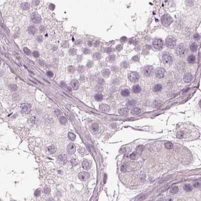 Immunohistochemistry-Paraffin: Filensin Antibody [NBP1-91903]