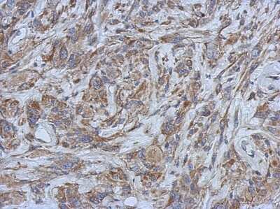Immunohistochemistry-Paraffin: Filensin Antibody [NBP2-16497]