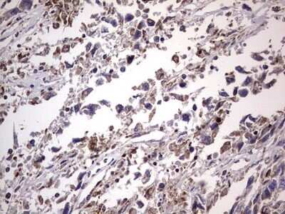 Immunohistochemistry: Filensin Antibody (OTI2B2) - Azide and BSA Free [NBP2-70249]