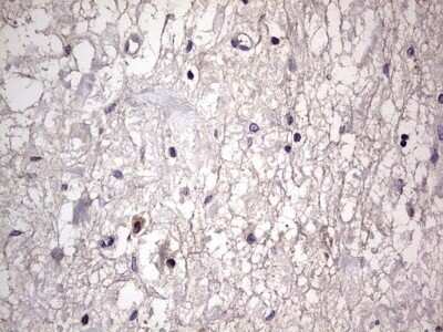 Immunohistochemistry: Filensin Antibody (OTI2B2) - Azide and BSA Free [NBP2-70249]