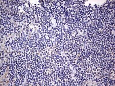 Immunohistochemistry: Filensin Antibody (OTI2B2) - Azide and BSA Free [NBP2-70249]