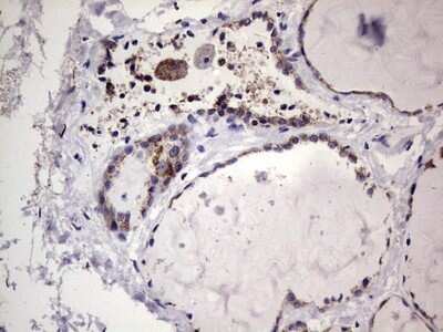 Immunohistochemistry: Filensin Antibody (OTI2B2) - Azide and BSA Free [NBP2-70249]