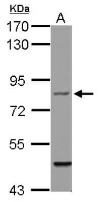 Western Blot: Filensin Antibody [NBP2-16497]