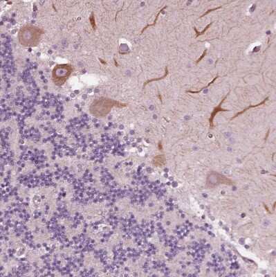 Immunohistochemistry-Paraffin: Flamingo homolog 1/CELSR3 Antibody [NBP2-38975]