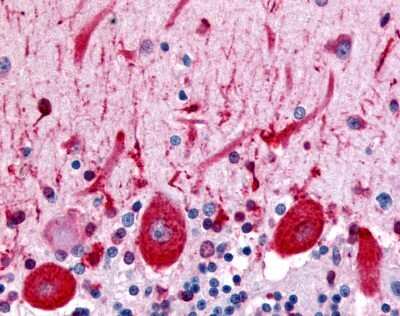 Immunohistochemistry-Paraffin: Flamingo homolog 1/CELSR3 Antibody - BSA Free [NLS1947]