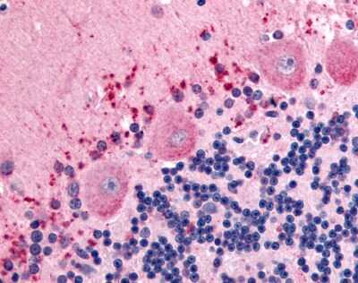 Immunohistochemistry-Paraffin: Flamingo homolog 1/CELSR3 Antibody - BSA Free [NLS2734]