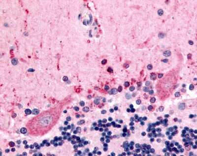 Immunohistochemistry-Paraffin: Flamingo homolog 1/CELSR3 Antibody - BSA Free [NLS2735]