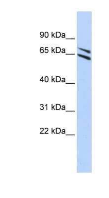 Western Blot: Flavin containing monooxygenase 4 Antibody [NBP1-59353]