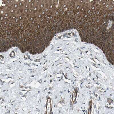 Immunohistochemistry-Paraffin: Flightless I Antibody [NBP1-87925]