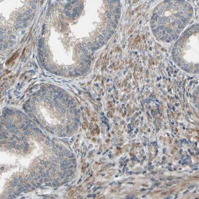 Immunohistochemistry-Paraffin: Flightless I Antibody [NBP1-87925]