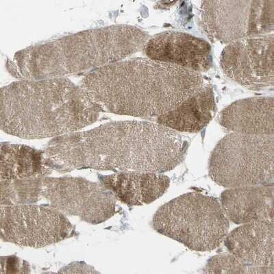 Immunohistochemistry-Paraffin: Flightless I Antibody [NBP1-87925]