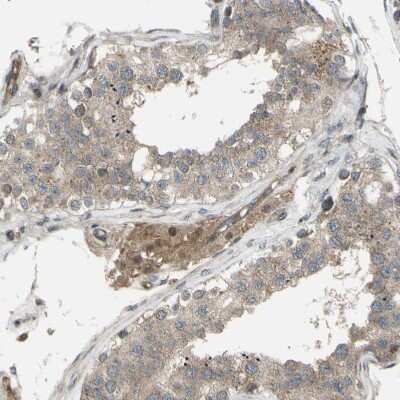 Immunohistochemistry-Paraffin: Flightless I Antibody [NBP1-87925]