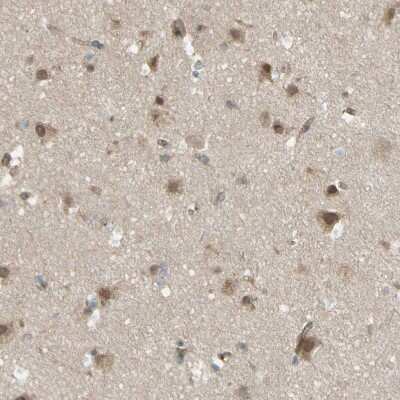 Immunohistochemistry-Paraffin: Flightless I Antibody [NBP1-87926]
