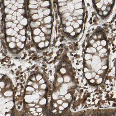 Immunohistochemistry-Paraffin: Flightless I Antibody [NBP1-87926]